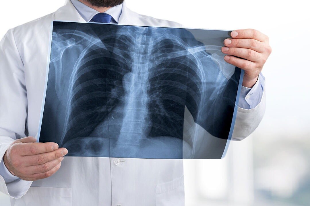 RADIOLOGIA